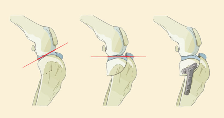 MASTERCLASS IN TPLO (Osteotomia Livellante del Piatto Tibiale)